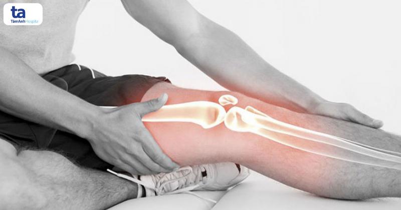 Tổng hợp các dấu hiệu bệnh ung thư xương phổ biến cần chú ý như đau, sưng, giới hạn vận động.
